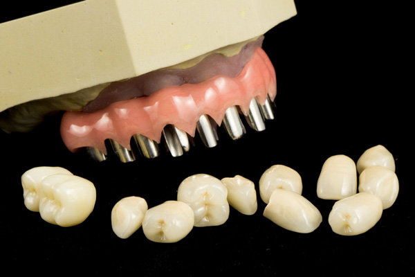 Individually Removable Crowns